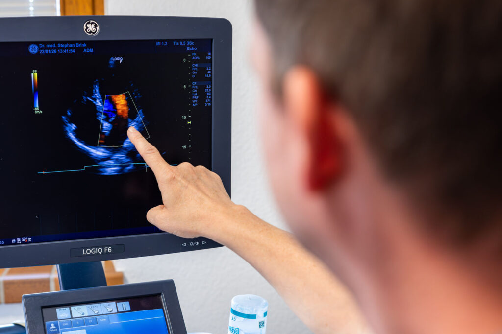 Ultraschalluntersuchung des Herzens